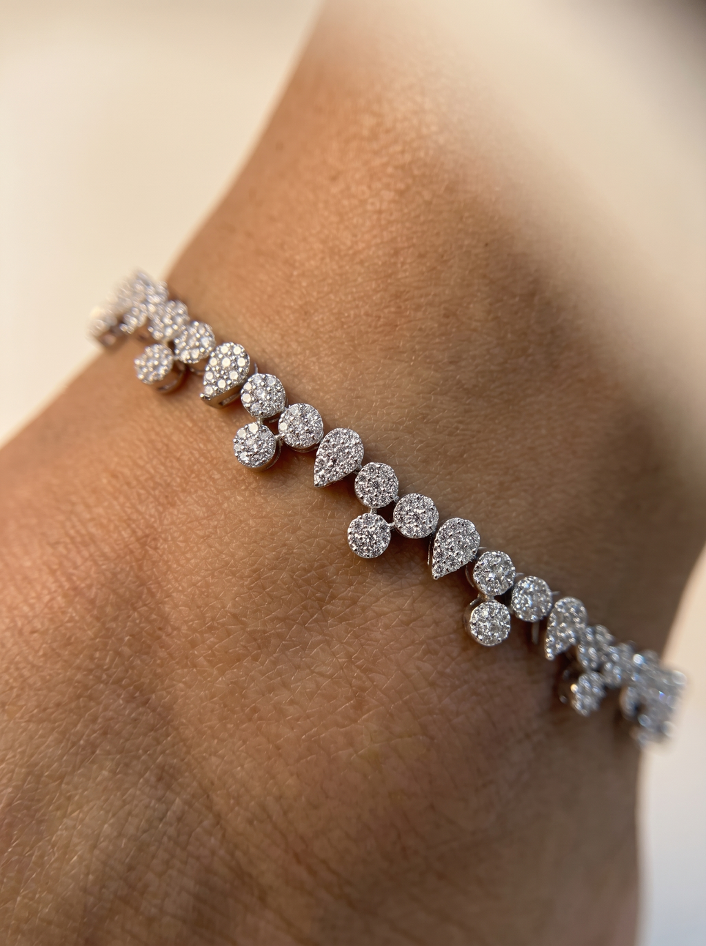 Sia Dewdrop Anklets