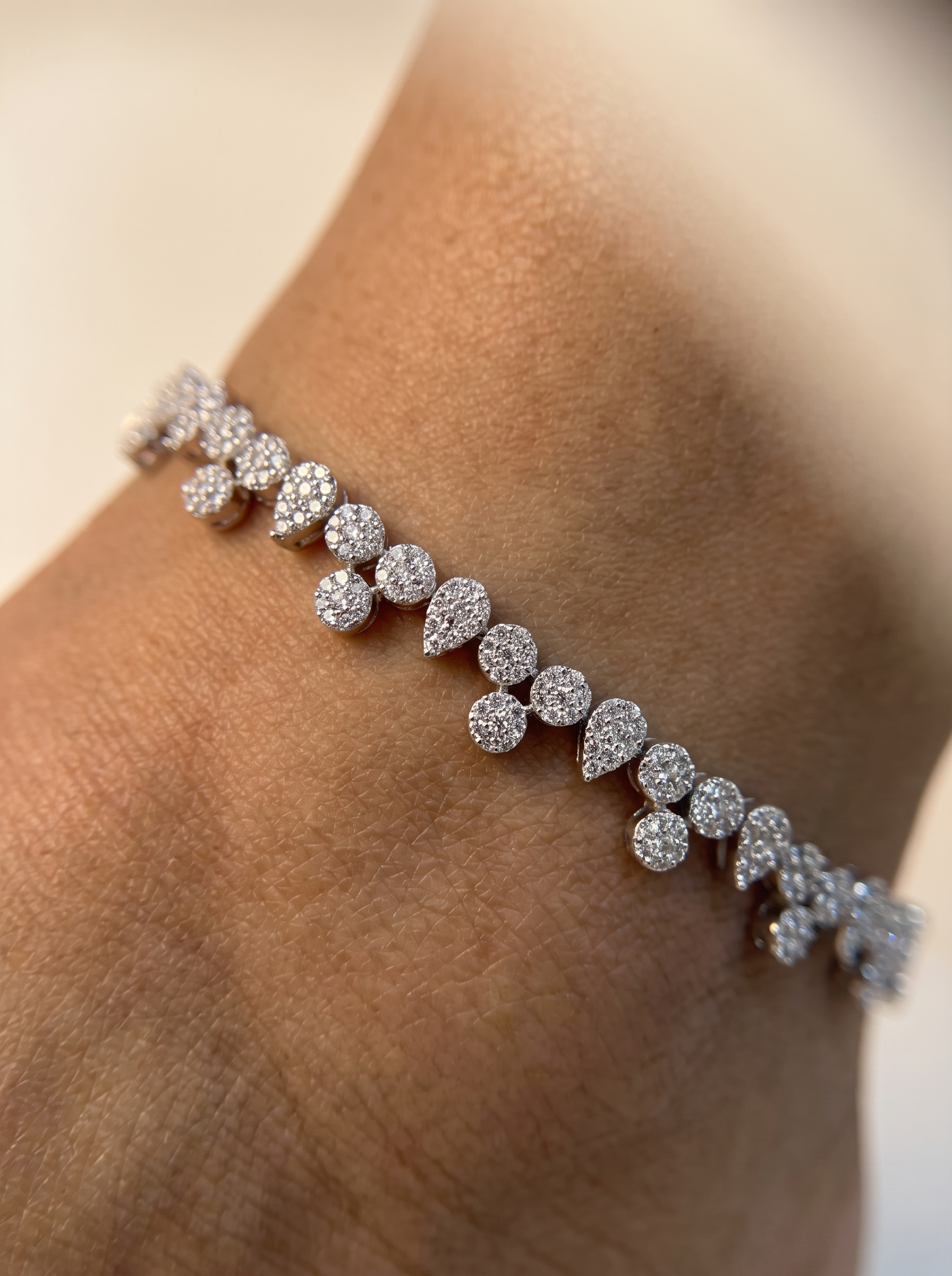 Sia Dewdrop Anklets